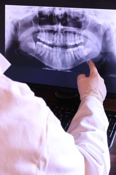 Best Emergency Orthodontic Repairs in Iowa City, IA